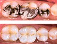 Esthetic Dentistry